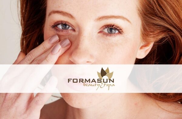 trattamento borse e occhiaie