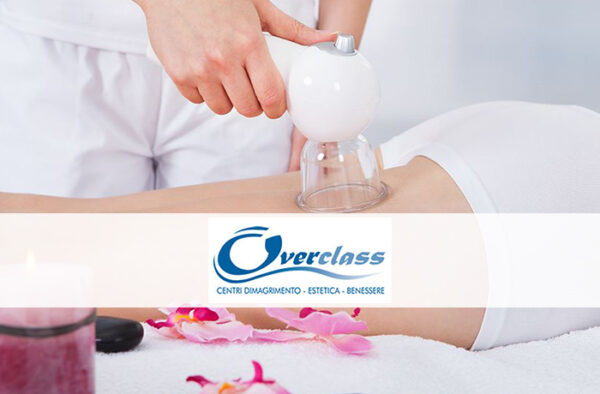 coppettazione overclass milano