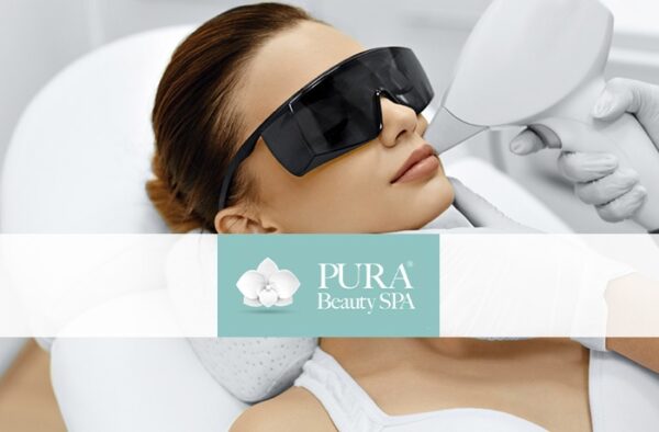 epilazione laser diodo baffetti pura beauty catania