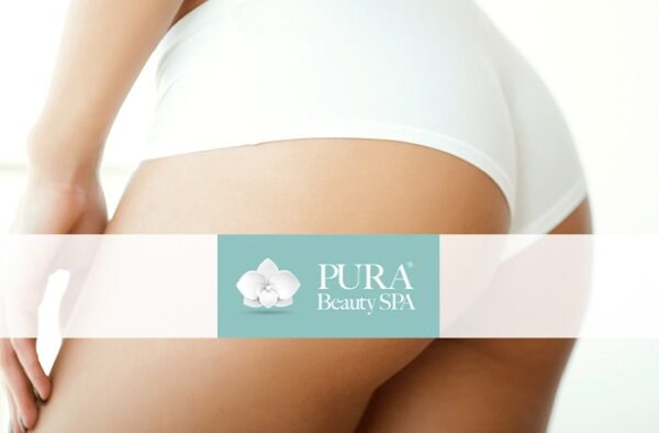 epilazione laser diodo glutei pura beauty catania