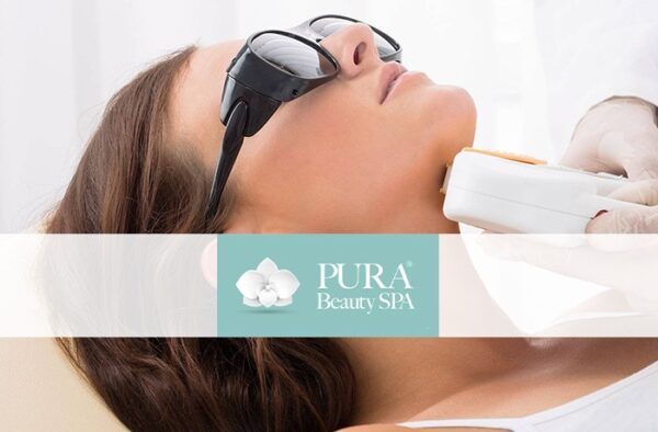 epilazione laser diodo mento pura beauty catania