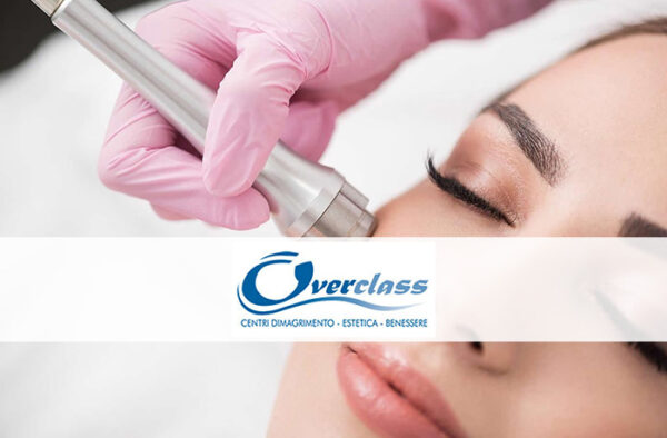 microdermoabrasione viso overclass milano