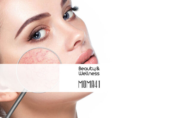 trattamento viso rosacea e couperose