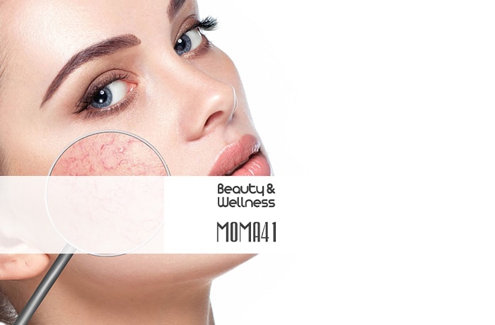 trattamento viso rosacea e couperose