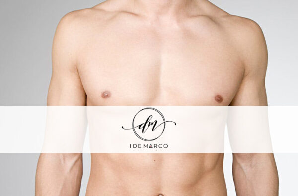 LASER-A-DIODO-PETTO-UOMO-I-DE-MARCO-GRAVINA DI CATANIA