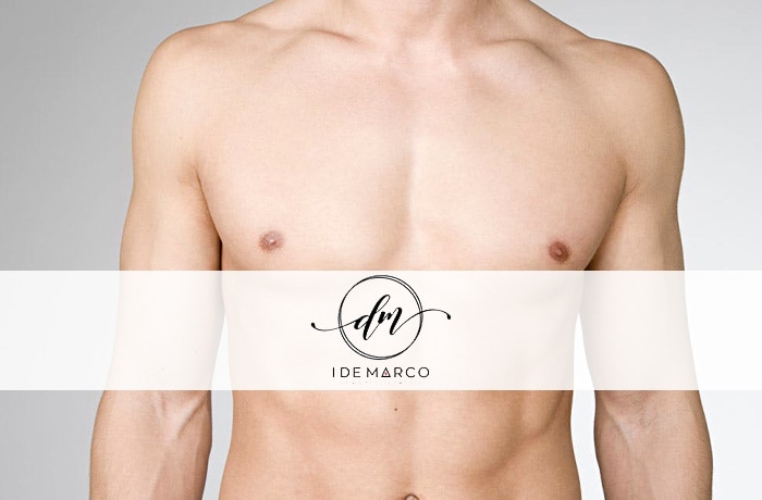 LASER-A-DIODO-PETTO-UOMO-I-DE-MARCO-GRAVINA DI CATANIA